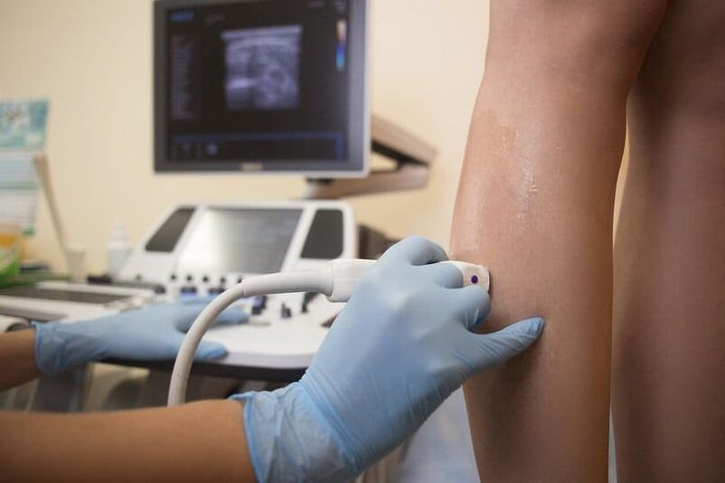 Ultraschalldiagnostik von Krampfadern.